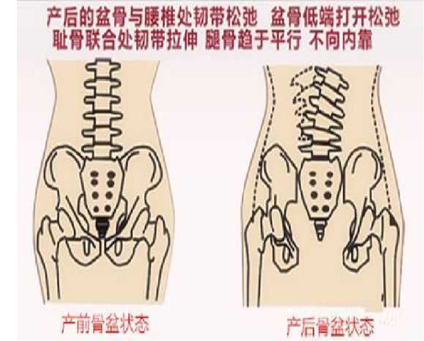 产康精品班产后盆骨恢复技巧